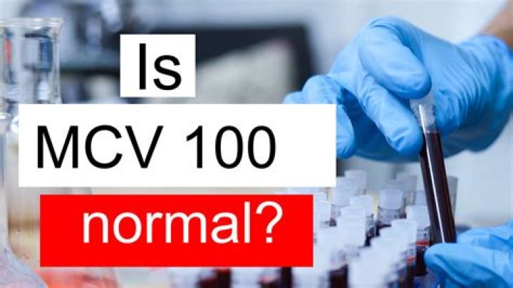 What does MCV of 100 mean