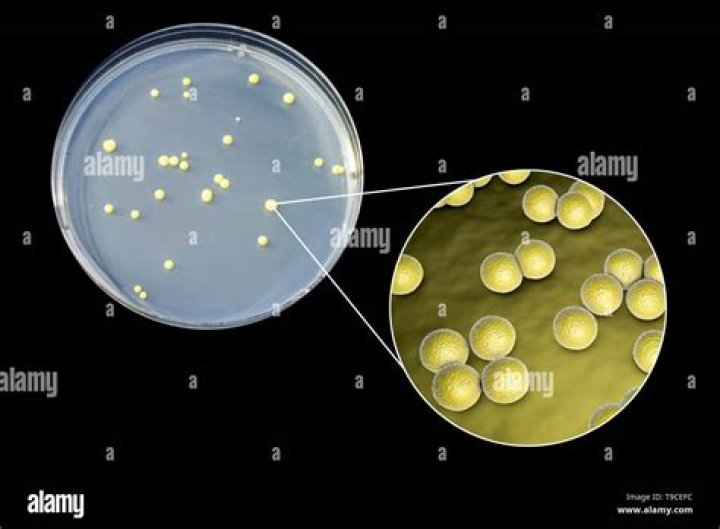 What does Micrococcus luteus look like