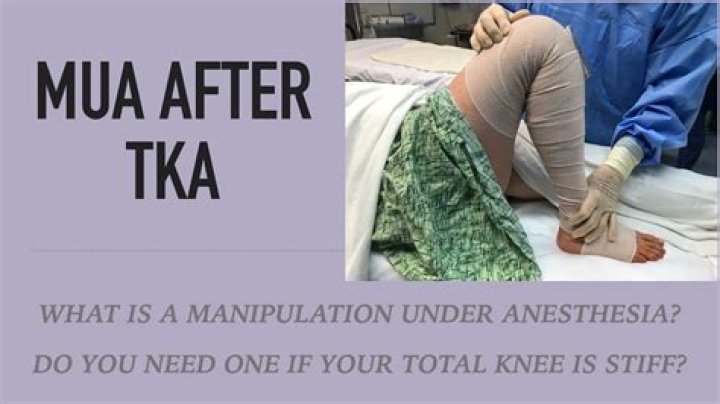 What does MUA mean in medical terms