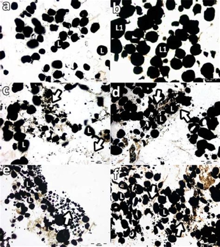 What does osmium tetroxide stain