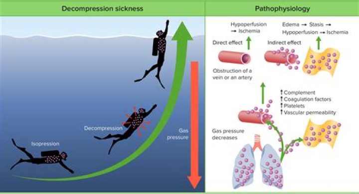 What gas is responsible for decompression sickness