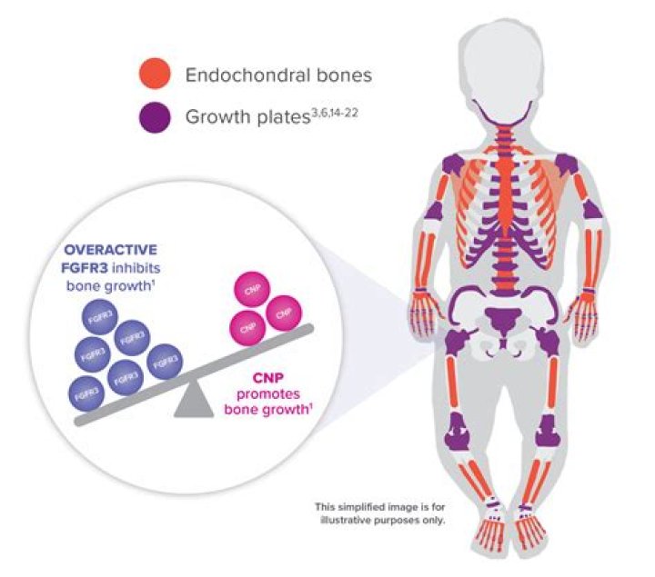 What happens in the body to cause achondroplasia