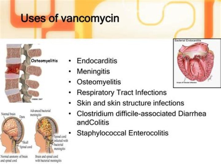 What infections is vancomycin used for