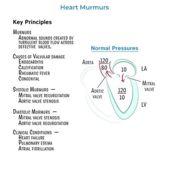 What is a 4/6 heart murmur