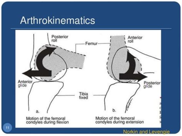 What is Arthrokinetic dysfunction
