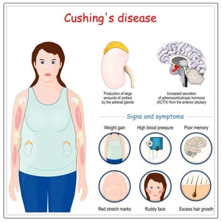What is atypical Cushings