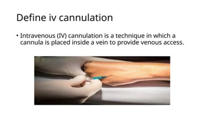 What is cannulation procedure