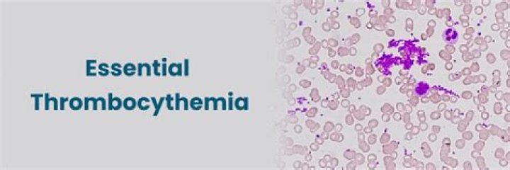 What is essential hemorrhagic thrombocythemia