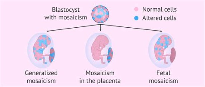 What is fetal mosaicism