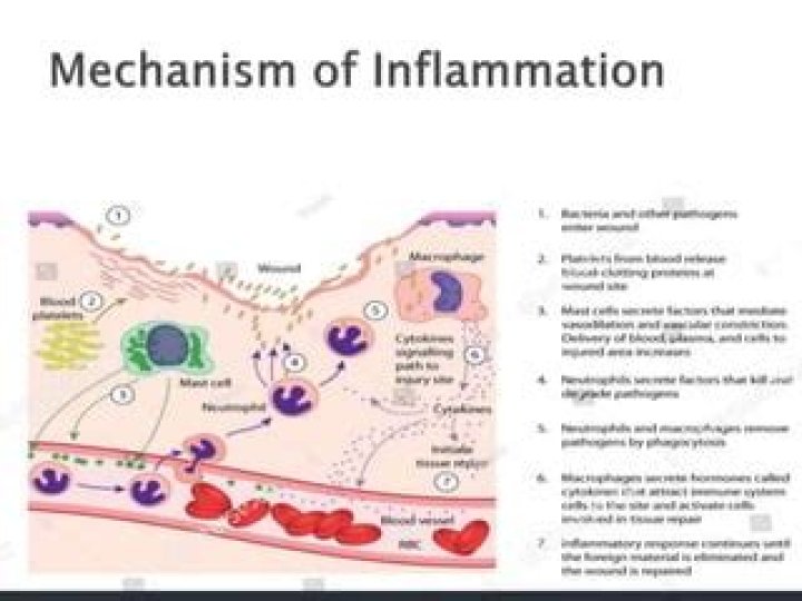 What is inflammation Slideshare