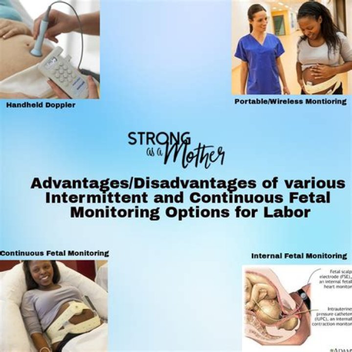 What is intermittent monitoring during labor