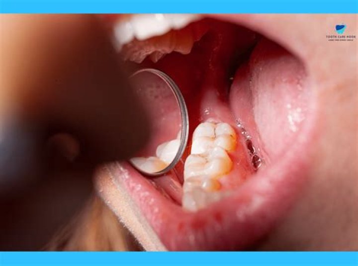 What is IRM dentistry
