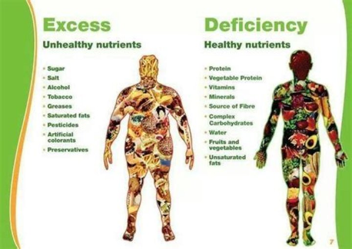 What is nutrition excess