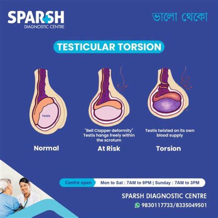 What is penile torsion