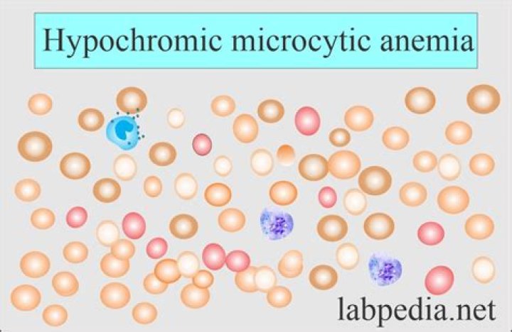 What is RBC morphology Hypochromia