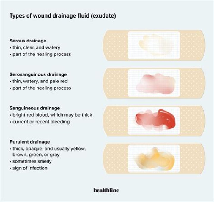 What is serous drainage
