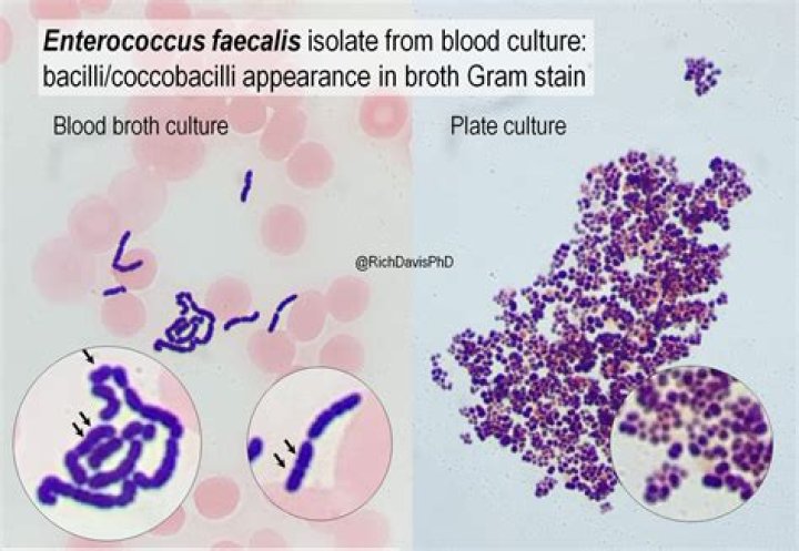 What is the common name for Enterococcus faecium