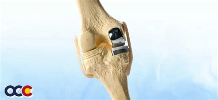 What is the CPT code for unicompartmental knee replacement