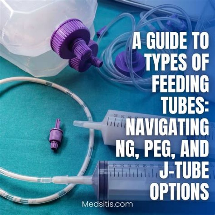 What is the difference between PEG tube and J tube