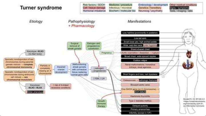 What is the gender of someone with Turners syndrome
