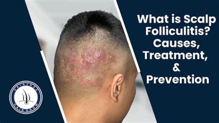 What is the mean of scalp