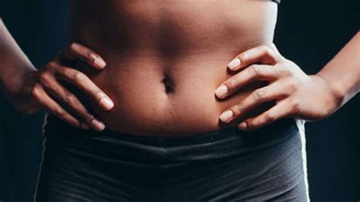 What is the medical terminology for tummy tuck