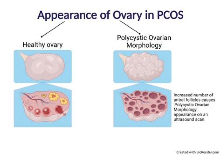 What is the PCO exam