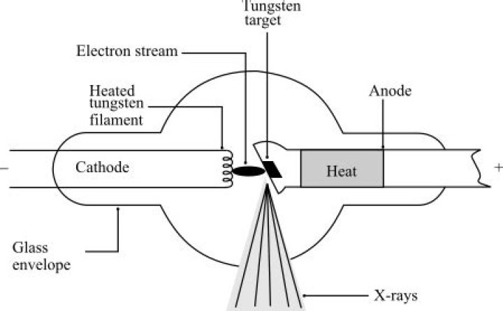 What is the process of X ray recording of a vein after injection of a contrast medium