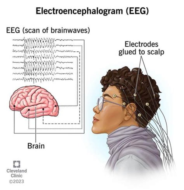 What is the suffix of electroencephalogram