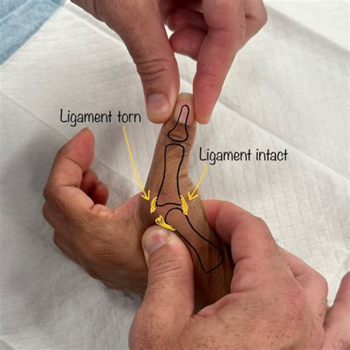 What is thumb latch