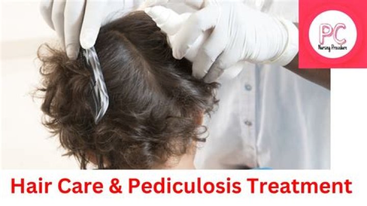 What is treatment of pediculosis