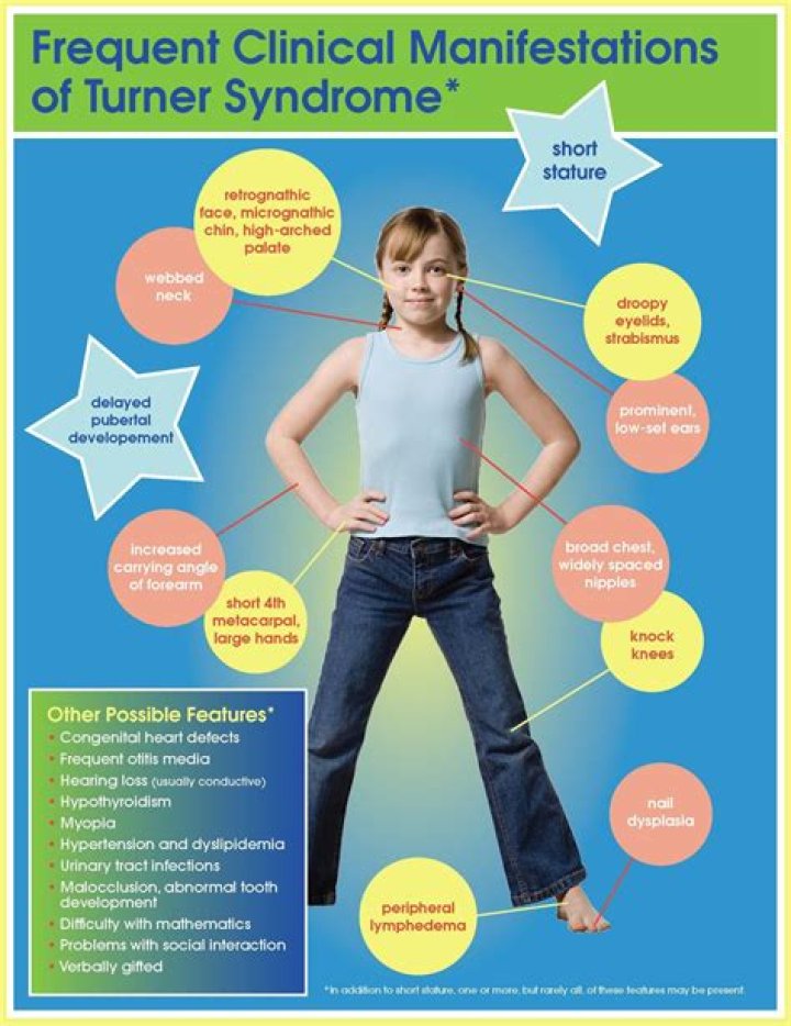 What test are done for Turner syndrome