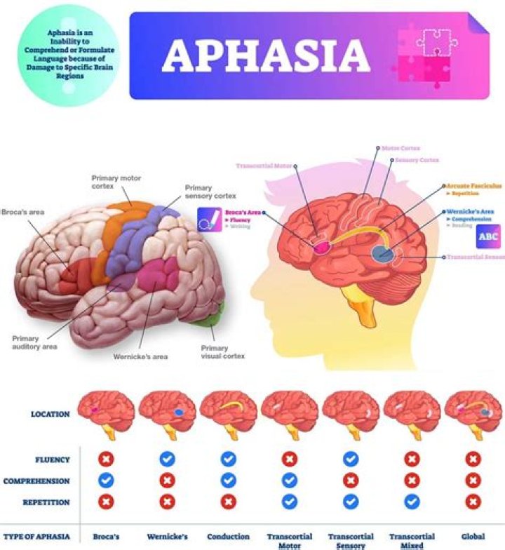 What type of stroke causes expressive aphasia