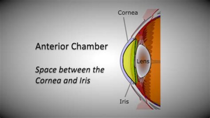 Where is the anterior chamber of the eye