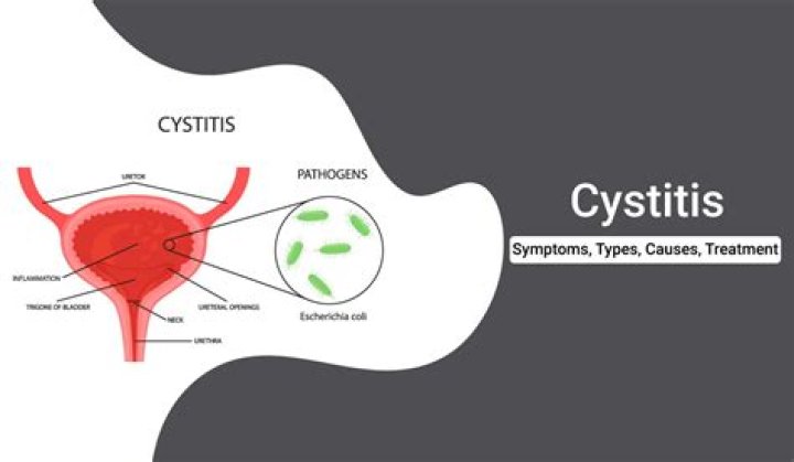 Which of the following are common symptoms of cystitis
