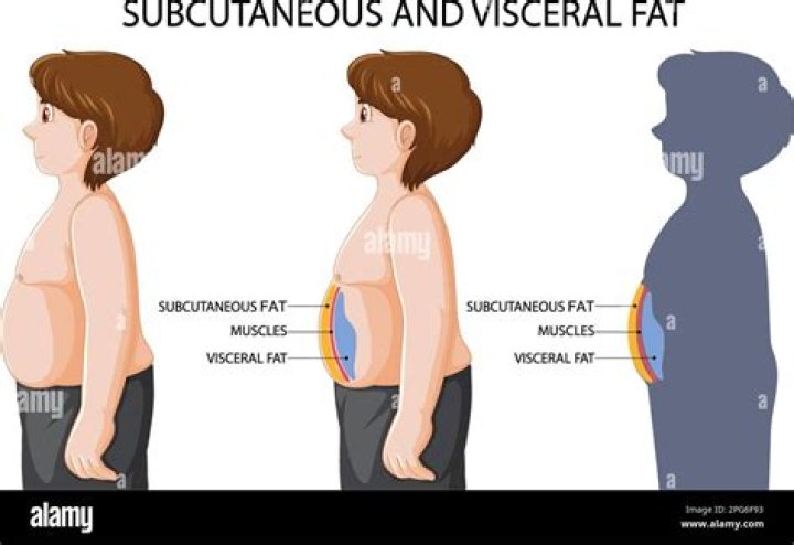 Why do I have so much subcutaneous fat