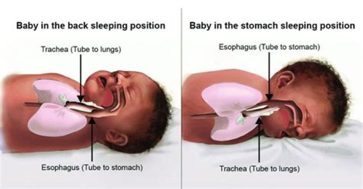 Why should babies not sit in the W position